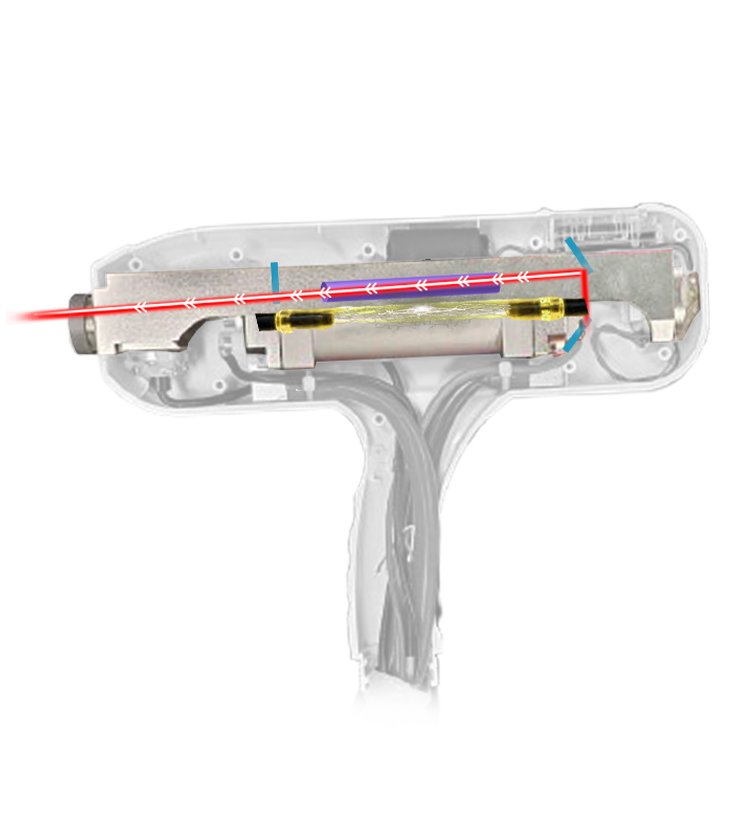 Q-Wipe - Laser para PMU